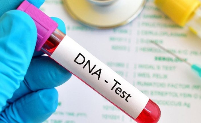 156 milyonluk DNA testi: Türkiye'de bir ilk...